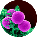 MRSA superbug