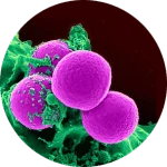 MRSA superbug